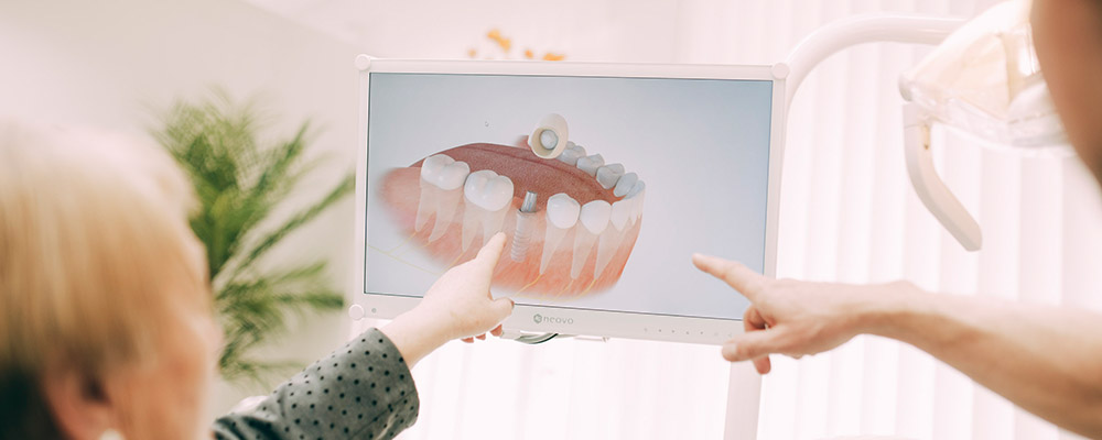 Zahnarzt erklärt Patientin, wie Zahnimplantate aus Berlin-Spandau ihr helfen. 