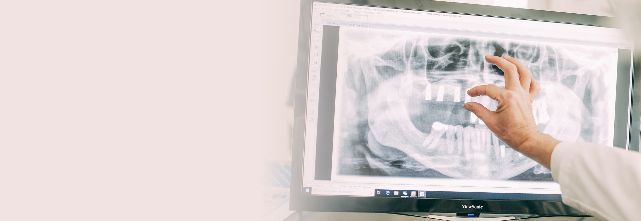 Digitales Röntgen beim Zahnarzt Dr. Kurth & Partner in Berlin-Spandau.